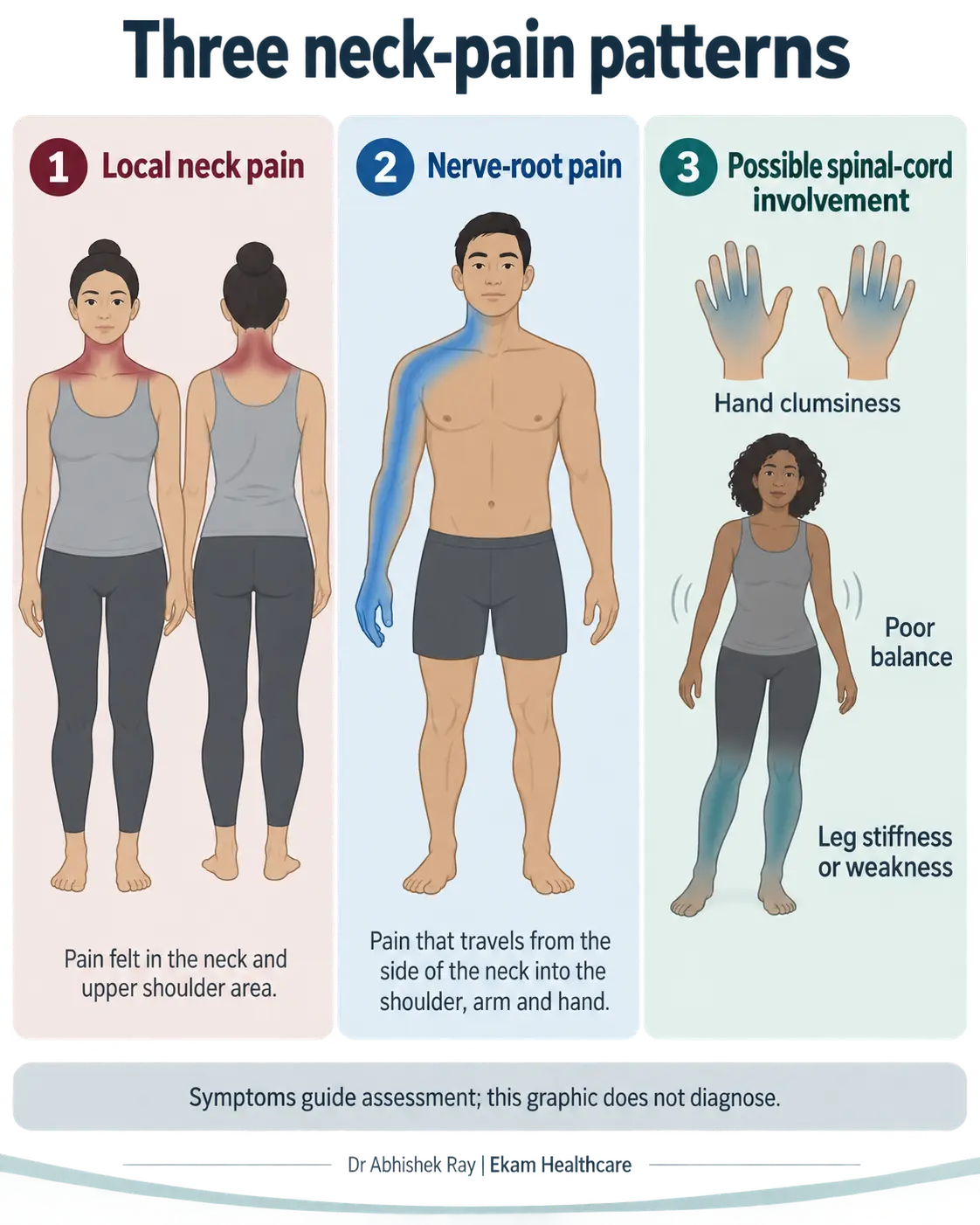 Illustration comparing local mechanical neck pain, cervical radiculopathy and cervical myelopathy